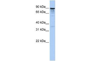 WB Suggested Anti-MCTP1 Antibody Titration:  1 ug/ml  Positive Control:  Hela cell lysate (MCTP1 抗体  (Middle Region))