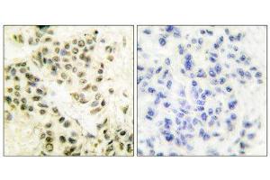 Immunohistochemistry (IHC) image for anti-Protein Kinase, DNA-Activated, Catalytic Polypeptide (PRKDC) (C-Term) antibody (ABIN1848510) (PRKDC 抗体  (C-Term))