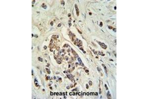 Immunohistochemistry (IHC) image for anti-ATP-Binding Cassette, Sub-Family C (CFTR/MRP), Member 11 (ABCC11) antibody (ABIN3002133) (ABCC11 抗体)