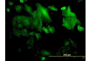 Immunofluorescence of monoclonal antibody to SDCBP on HepG2 cell. (SDCBP 抗体  (AA 1-100))