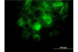 Immunofluorescence of monoclonal antibody to ITGA2 on A-431 cell. (ITGA2 抗体  (AA 30-119))