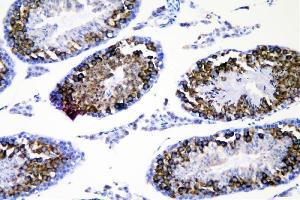 IHC analysis of DDX4 using anti-DDX4 antibody (ABIN7601203). (DDX4 抗体  (AA 3-666))