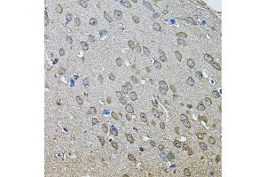 Immunohistochemistry of paraffin-embedded mouse brain using ANXA8L2 antibody (ABIN5975720) at dilution of 1/100 (40x lens). (ANXA8L2 抗体)