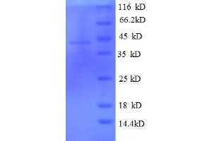 SDS-PAGE (SDS) image for Tubulin Folding Cofactor C (TBCC) (AA 2-345) protein (His tag) (ABIN5710458) (TBCC Protein (AA 2-345) (His tag))