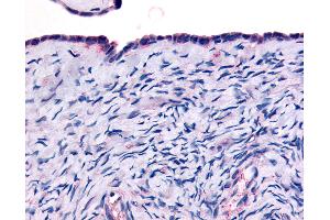 Anti-THRA antibody IHC of human surface epithelium. (THRA 抗体  (Ligand Binding Domain))