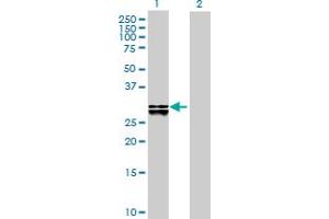 Western Blot analysis of DHRS4 expression in transfected 293T cell line by DHRS4 MaxPab polyclonal antibody. (DHRS4 抗体  (AA 1-278))