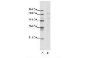 Image no. 1 for anti-Calcium Channel, Voltage-Dependent, beta 3 Subunit (CACNB3) (AA 391-440) antibody (ABIN202640) (CACNB3 抗体  (AA 391-440))