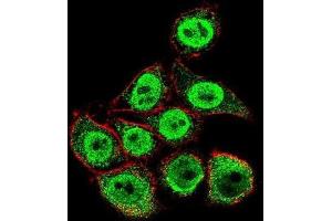 Immunofluorescence (IF) image for anti-Thymidylate Synthetase (TYMS) antibody (ABIN3002747) (TYMS 抗体)