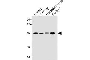 All lanes : Anti-SPNS2 Antibody (N-term) at 1:1000 dilution Lane 1: Human heart lysate Lane 2: Human kidney lysate Lane 3: Human skeletal muscle lysate Lane 4: SK-BR-3 whole cell lysate Lysates/proteins at 20 μg per lane. (SPNS2 抗体  (N-Term))