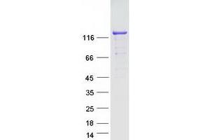 Western Blotting (WB) image for SLIT-ROBO rho GTPase Activating Protein 1 (SRGAP1) protein (Myc-DYKDDDDK Tag) (ABIN2714870)