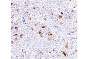 Immunohistochemistry (IHC) image for anti-Programmed Cell Death 1 Ligand 2 (PDCD1LG2) (Middle Region) antibody (ABIN1031035) (PDCD1LG2 抗体  (Middle Region))