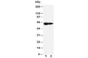 Western blot testing of IL-2 Receptor antibody and Lane 1:  PANC cell lysate (IL2 Receptor beta 抗体  (AA 117-135))