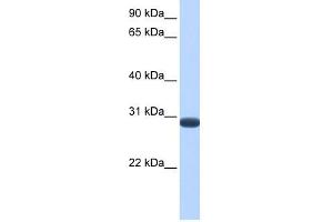 DUSP19 antibody used at 1 ug/ml to detect target protein. (DUSP19 抗体  (C-Term))