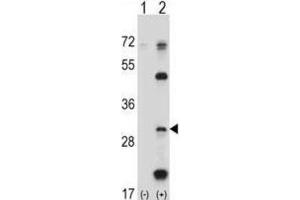 Western Blotting (WB) image for anti-Proteasome (Prosome, Macropain) Subunit, beta Type, 5 (PSMB5) antibody (ABIN2998050) (PSMB5 抗体)