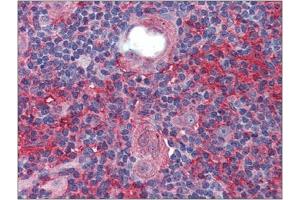 Immunohistochemistry: Human Thymus: Formalin-Fixed, Paraffin-Embedded (FFPE). (Cell Adhesion Molecule 4 抗体  (Internal Region))