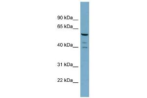 WB Suggested Anti-RABGEF1 Antibody Titration: 0. (RABGEF1 抗体  (N-Term))