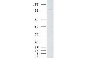 Western Blotting (WB) image for TAO Kinase 2 (TAOK2) (Transcript Variant 1) protein (Myc-DYKDDDDK Tag) (ABIN2733219)