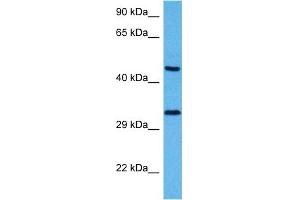 Host:  Mouse  Target Name:  SOX1  Sample Tissue:  Mouse Pancreas  Antibody Dilution:  1ug/ml (SOX1 抗体  (N-Term))