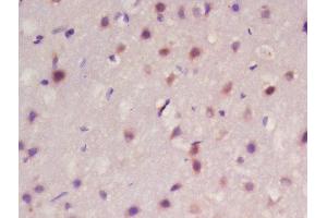 Formalin-fixed and paraffin embedded rat brain labeled with Rabbit Anti-Frizzled 10/CD350 Polyclonal Antibody, Unconjugated  at 1:200 followed by conjugation to the secondary antibody and DAB staining