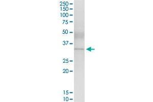 ZNF215 (Human) IP-WB Antibody Pair