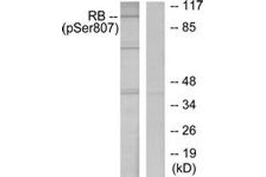 Western blot analysis of extracts from K562 cells treated with serum 10%, using Retinoblastoma (Phospho-Ser807) Antibody. (Retinoblastoma Protein (Rb) 抗体  (pSer807))