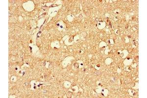 Immunohistochemistry of paraffin-embedded human brain tissue using ABIN7159344 at dilution of 1:100 (MLC1 抗体  (AA 1-49))