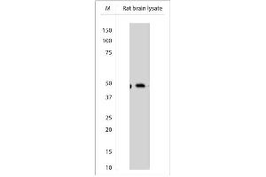 WB on rat brain lysate using Sheep antibody to Beclin-1 (400-450)    at 1:200 dilution. (Beclin 1 抗体)