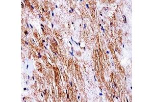 Ddr2 antibody immunohistochemistry analysis in formalin fixed and paraffin embedded mouse heart tissue. (DDR2 抗体  (AA 816-843))
