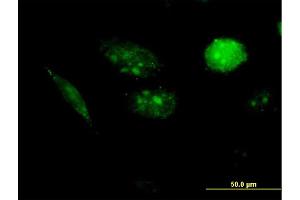 Immunofluorescence of purified MaxPab antibody to AURKAIP1 on HeLa cell. (AURKAIP1 抗体  (AA 1-199))