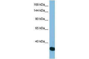Western Blotting (WB) image for anti-Ubiquitin Specific Peptidase 36 (USP36) (N-Term) antibody (ABIN2787328) (USP36 抗体  (N-Term))
