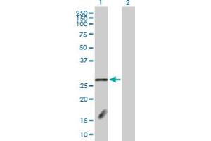 Western Blot analysis of FBXL18 expression in transfected 293T cell line by FBXL18 MaxPab polyclonal antibody. (FBXL18 抗体  (AA 1-259))
