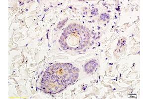 Immunohistochemistry (IHC) image for anti-Glutamate Receptor, Ionotropic, N-Methyl D-Aspartate 2a (GRIN2A) (AA 851-950) antibody (ABIN747353)