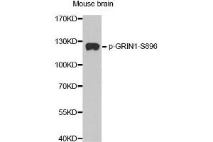 Western blot analysis of extracts from mouse Brain tissue, using phospho-GRIN1-S896 antibody (ABIN2987488). (GRIN1/NMDAR1 抗体  (pSer896))
