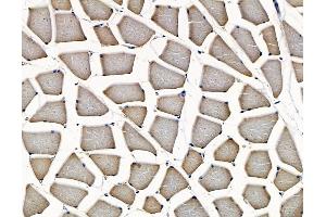 ABIN7096991 and ABIN7101058 at 1/100 staining rat muscle tissue by IHC-P. (DOCK4 抗体)