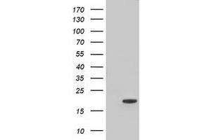 HEK293T cells were transfected with the pCMV6-ENTRY control (Left lane) or pCMV6-ENTRY TTC32 (Right lane) cDNA for 48 hrs and lysed. (TTC32 抗体)