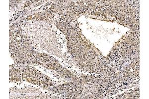 IHC analysis of KHSRP using anti-KHSRP antibody (ABIN7599776).