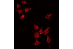 ABIN6274475 staining HeLa by IF/ICC. (PGBD1 抗体  (Internal Region))