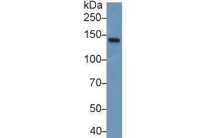 Detection of NEF3 in Mouse Spinal cord lysate using Polyclonal Antibody to Neurofilament 3 (NEF3) (NEFM 抗体  (AA 105-287))