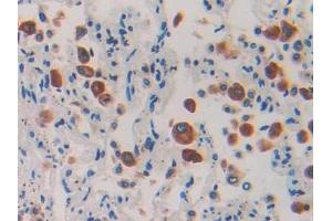 IHC-P analysis of Human Lung Tissue, with DAB staining. (IL1RAP 抗体  (AA 65-249))