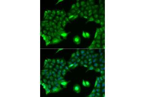 Immunofluorescence analysis of HeLa cell using SSX2 antibody. (SSX2 抗体)