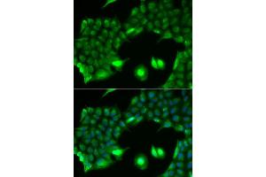 Immunofluorescence analysis of HeLa cell using SSX2 antibody. (SSX2 抗体)