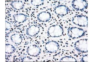 Image no. 4 for anti-Checkpoint Kinase 2 (CHEK2) antibody (ABIN1497497)