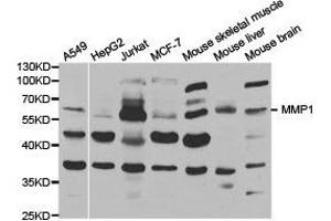 Western Blotting (WB) image for anti-Matrix Metallopeptidase 1 (Interstitial Collagenase) (MMP1) antibody (ABIN1873712) (MMP1 抗体)