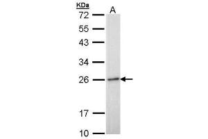 Western Blotting (WB) image for anti-RAB6A, Member RAS Oncogene Family (RAB6A) antibody (ABIN2856770)