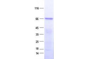 ZNF572 Protein (His tag)