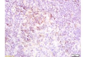 Formalin-fixed and paraffin embedded mouse spleen labeled with Rabbit Anti-TSHR Polyclonal Antibody (ABIN668901) at 1:200 followed by conjugation to the secondary antibody and DAB staining (TSH receptor 抗体  (AA 501-600))