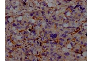 Immunohistochemistry (IHC) image for anti-Activin A Receptor Type II-Like 1 (ACVRL1) antibody (ABIN7127322)