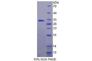 SDS-PAGE analysis of Human ADAM22 Protein. (ADAM22 蛋白)