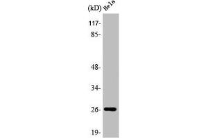 Western Blot analysis of COLO205 cells using APRIL Polyclonal Antibody (TNFSF13 抗体  (Internal Region))