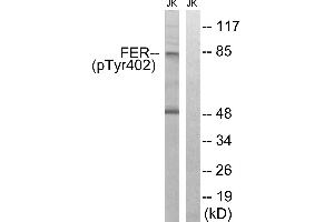 Immunohistochemistry analysis of paraffin-embedded human brain tissue using FER (Phospho-Tyr402) antibody. (FER 抗体  (pTyr402))